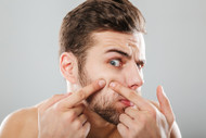 8 Easy Tricks To Keep Beard Pimples at Bay
