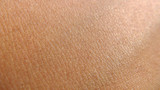 INFLAMMATION AND ITS EFFECTS ON THE SKIN