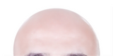 Real cure for baldness?  USC stem cell scientists developing a new cure-all for baldness.... 