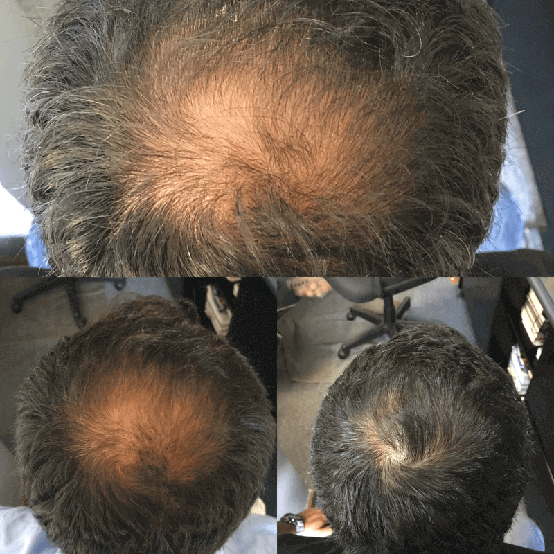 Mens Before and After with Help Hair Shake