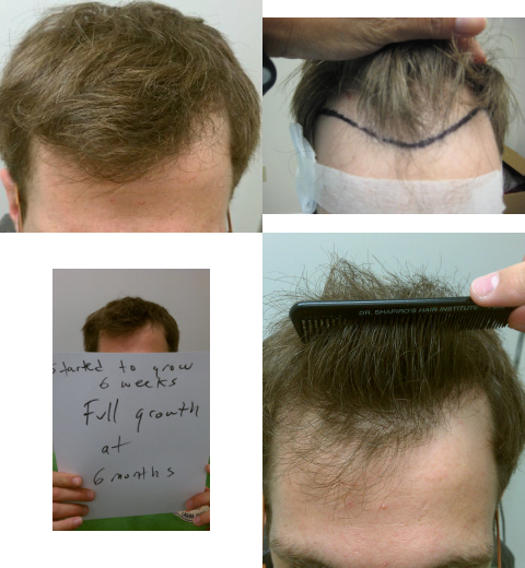 How to Make Hair Grow Faster | Grow Hair Faster | Help Hair Shake