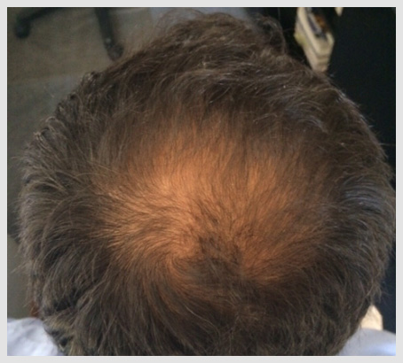 Help Hair Hair Loss Vitamins Reviews