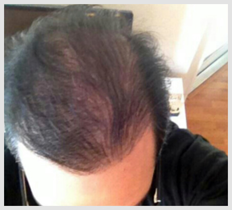 Hair Loss Vitamins Reviews