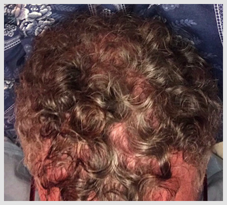 Before/After using Help Hair Shake and Help Hair Vitamins