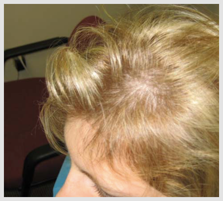 Hair Loss products Reviews