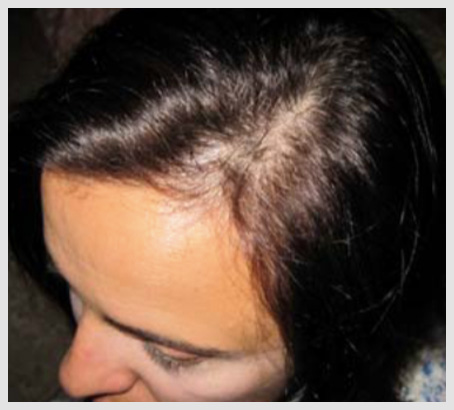 Help Hair Shake daily Usages