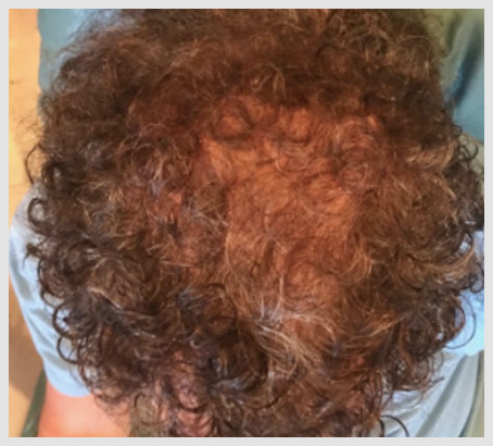 Help Hair Shake daily Usages