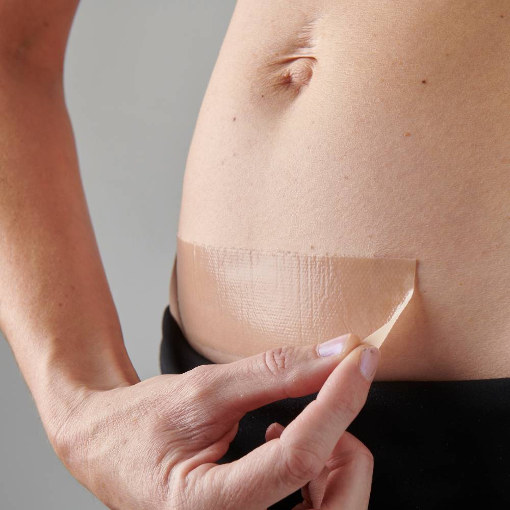 myscar The Active Caesarean Silicone Strips