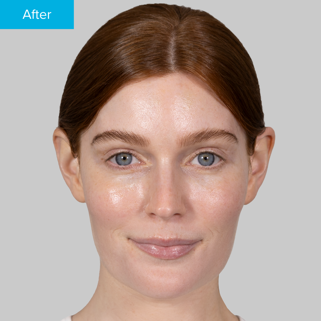 Hyaluronic Acid Serum Hyaluronic Acid Serum
