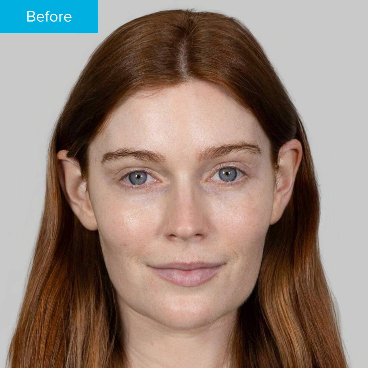 Hyaluronic Acid Serum Hyaluronic Acid Serum