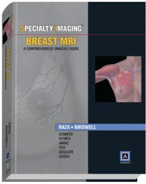 http://axebook.shop/wp-content/uploads/2025/03/specialty-imaging-breast-mri-a-comprehensive-imaging-guide-published-by-amirsys-reg-specialty-imaging-breast-mri-a-comprehensive-imaging-guide-published-by-amirsys-reg.jpg