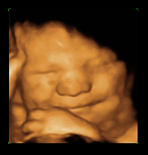 3D/4D Ultrasound LIVE DELUXE Sonogram Package (40% Off promo) 