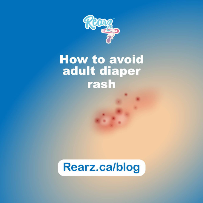 Tips For Preventing Adult Diaper Rashes