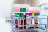 Role of Blood Collection Tube Additives in a Pathology Lab
