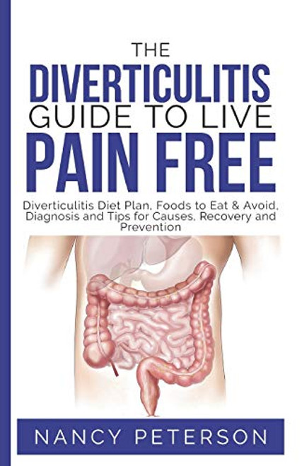 The Diverticulitis Guide to Live Pain Free: Diverticulitis Diet Plan, Foods to Eat & Avoid, Diagnosis and Tips for Causes, Recovery and Prevention By Nancy Peterson - Paperback