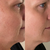 Eco Sonya Organic & Natural Serum of Plenty Kit - customer review before and after image Eco Sonya Organic & Natural Serum of Plenty Kit - customer review before and after image