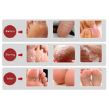 Avante Silk Touch Pedi Peel