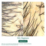 Biolage Scalp Sync Oil Balancing Serum Biolage Scalp Sync Oil Balancing Serum