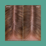 Biolage Scalp Sync For Dry/Sensitive Scalp Trio Bundle