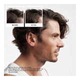 Nioxin Scalp + Hair Thickening System 2 Full Size Kit