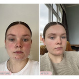 Pro Juvenate Alpha Resurfacer