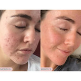 Pro Juvenate ReAlign Advanced