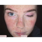 Pro Juvenate ReAlign Advanced