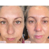 Pro Juvenate ReAlign Advanced