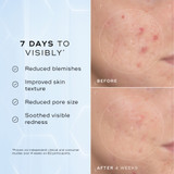 MEDIK8 Niacinamide Peptides