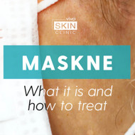 MASKNE: What it is & How to treat