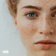 HYPERPIGMENTATION: What is it, and how can we treat it?