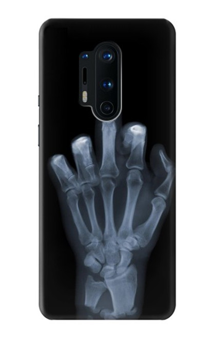 S1143 X-ray Hand Middle Finger Funda Carcasa Case para OnePlus 8 Pro