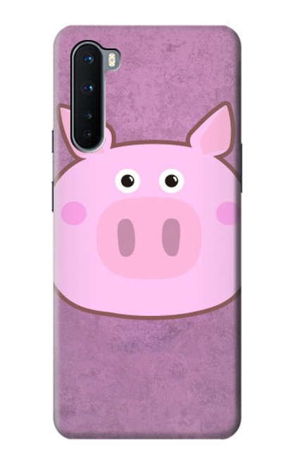 S3269 Pig Cartoon Funda Carcasa Case para OnePlus Nord