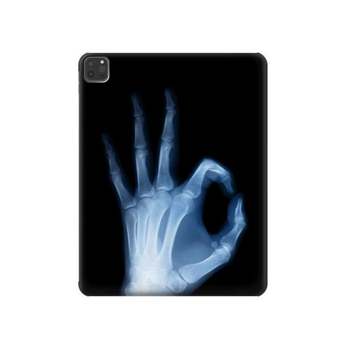 S3239 X-Ray Hand Sign OK Funda Carcasa Case para iPad Pro 11 (2021,2020,2018, 3rd, 2nd, 1st)