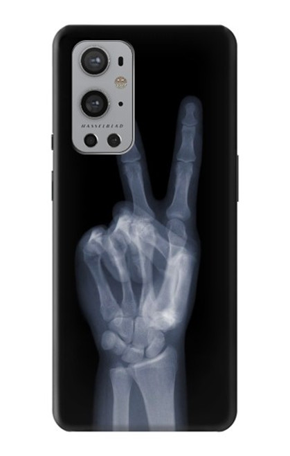 S3101 X-ray Peace Sign Fingers Funda Carcasa Case para OnePlus 9 Pro