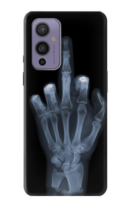 S1143 X-ray Hand Middle Finger Funda Carcasa Case para OnePlus 9