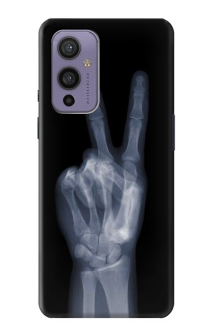 S3101 X-ray Peace Sign Fingers Funda Carcasa Case para OnePlus 9