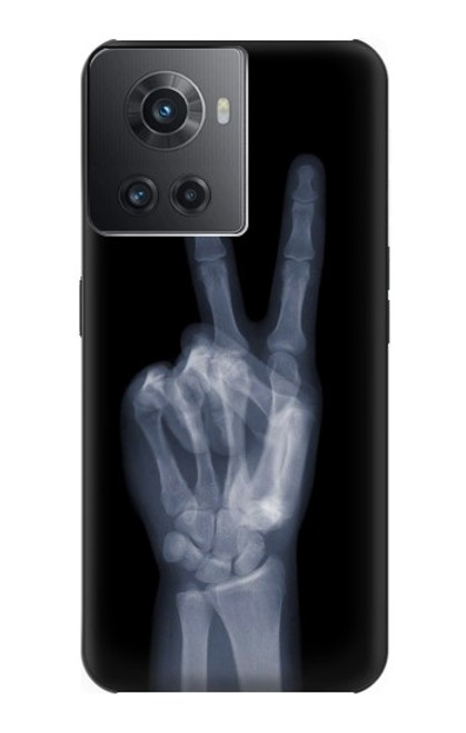 S3101 X-ray Peace Sign Fingers Funda Carcasa Case para OnePlus 10R