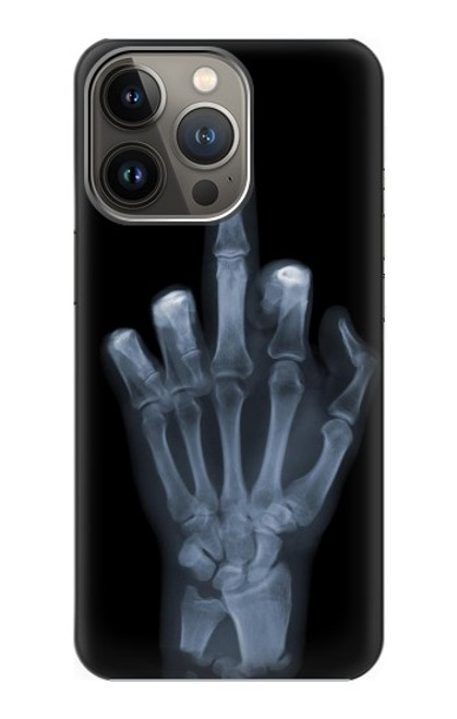 S1143 X-ray Hand Middle Finger Funda Carcasa Case para iPhone 14 Pro