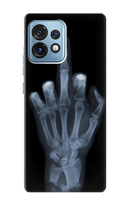 S1143 X-ray Hand Middle Finger Funda Carcasa Case para Motorola Edge+ (2023), X40, X40 Pro, Edge 40 Pro