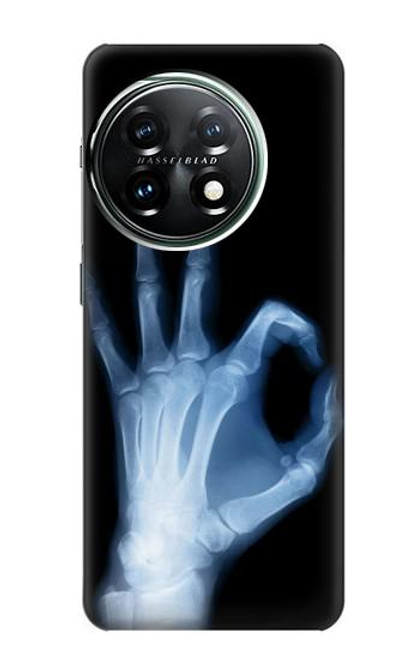 S3239 X-Ray Hand Sign OK Funda Carcasa Case para OnePlus 11