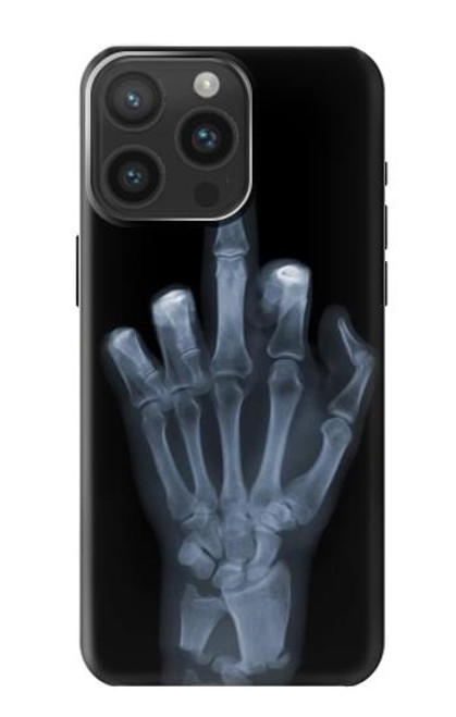 S1143 X-ray Hand Middle Finger Funda Carcasa Case para iPhone 15 Pro Max