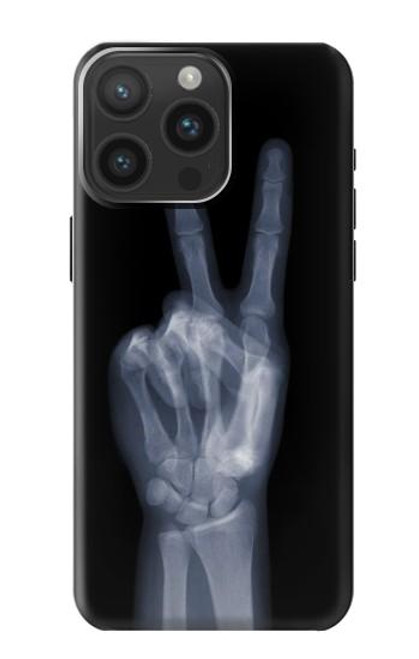 S3101 X-ray Peace Sign Fingers Funda Carcasa Case para iPhone 15 Pro Max