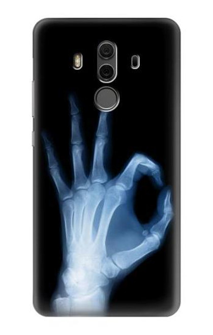 S3239 X-Ray Hand Sign OK Funda Carcasa Case para Huawei Mate 10 Pro, Porsche Design