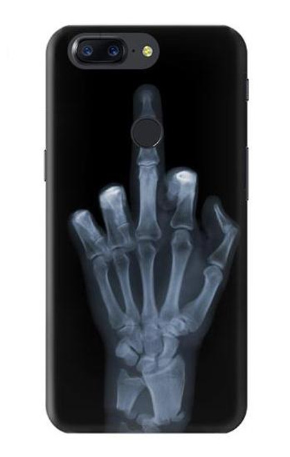 S1143 X-ray Hand Middle Finger Funda Carcasa Case para OnePlus 5T