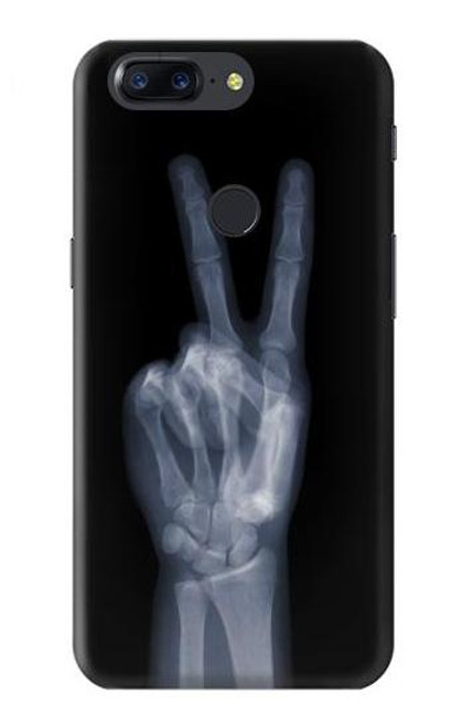 S3101 X-ray Peace Sign Fingers Funda Carcasa Case para OnePlus 5T