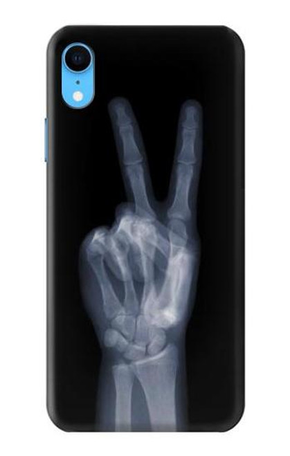 S3101 X-ray Peace Sign Fingers Funda Carcasa Case para iPhone XR