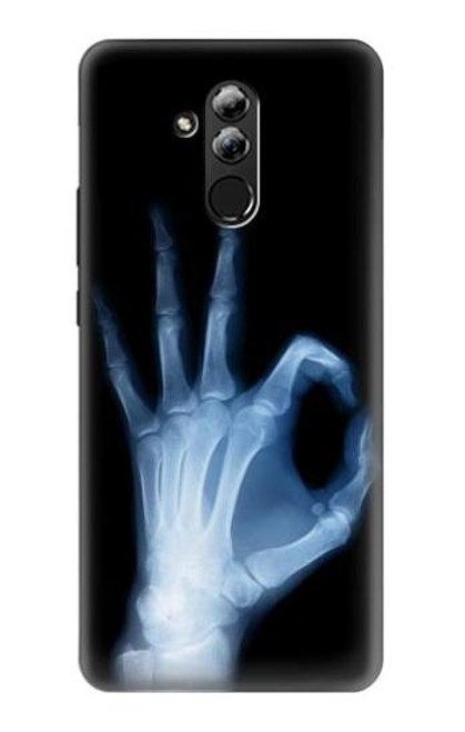 S3239 X-Ray Hand Sign OK Funda Carcasa Case para Huawei Mate 20 lite