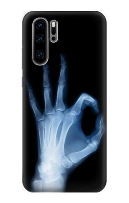 S3239 X-Ray Hand Sign OK Funda Carcasa Case para Huawei P30 Pro