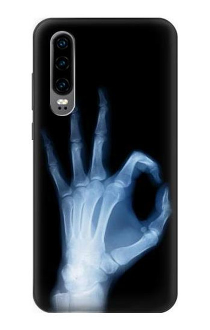 S3239 X-Ray Hand Sign OK Funda Carcasa Case para Huawei P30